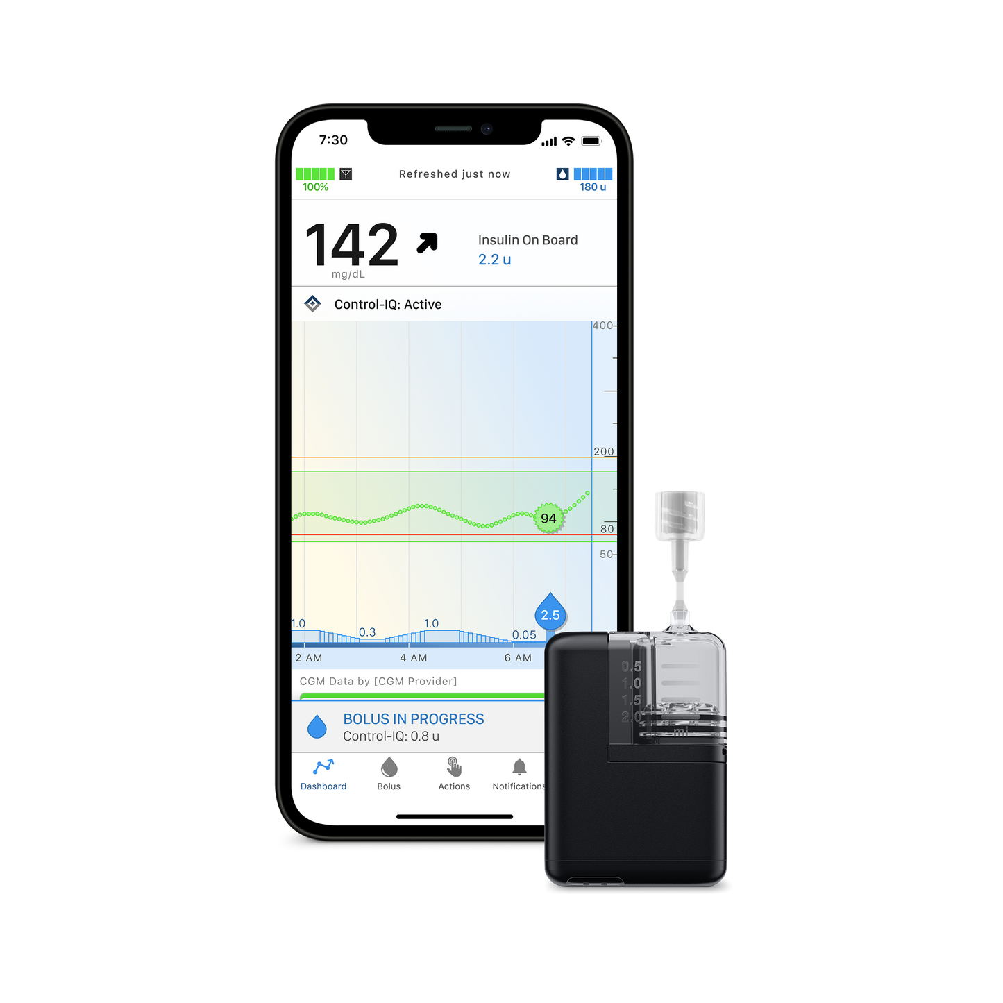 Mobi Insulin Pump System