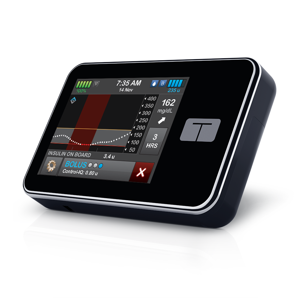 t:slim X2 Insulin Pump – Reliable Diabetes Care